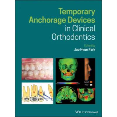 Temporary Anchorage Devices in Clinical Orthodontics | Jae Hyun Park