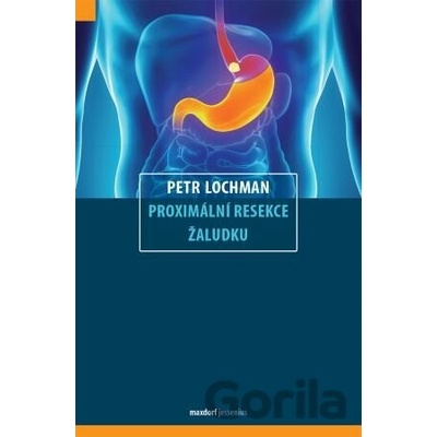 Proximální resekce žaludku - Petr Lochman