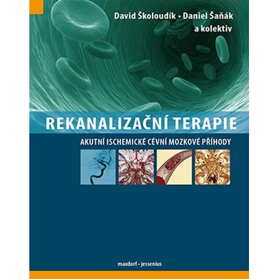 Rekanalizační terapie - Akutní ischemické cévní mozkové příhody David a kolekti
