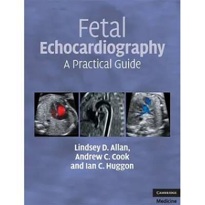Fetal Echocardiography | Lindsey D Allan