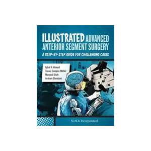 Illustrated Advanced Anterior Segment Surgery | I. Ahmed (ISBN: 9781630911843)