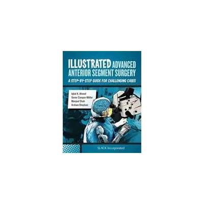 Illustrated Advanced Anterior Segment Surgery | I. Ahmed