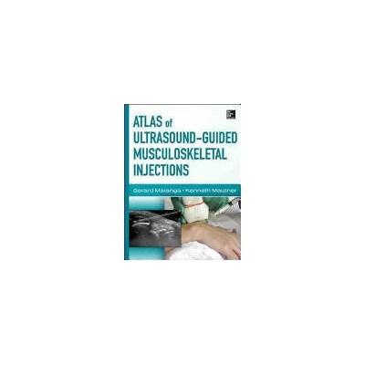 Atlas of Ultrasound-Guided Musculoskeletal Injections | Gerard Malanga