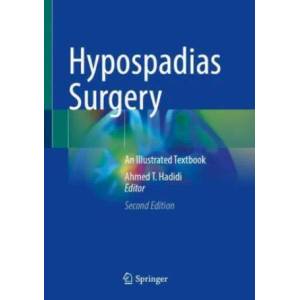 Hypospadias Surgery | Ahmed T. Hadidi (ISBN: 9783030942472)