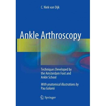 Ankle Arthroscopy