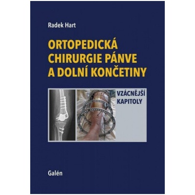 Ortopedická chirurgie pánve a dolní končetiny