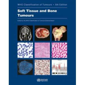WHO classification of tumours of soft tissue and bone tumours | WHO Classification of Tumours Editorial Board (ISBN: 9789283245025)