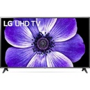 LG 70UN7070