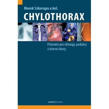 Chylothorax