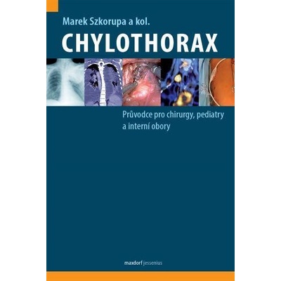 Chylothorax