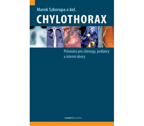 Chylothorax