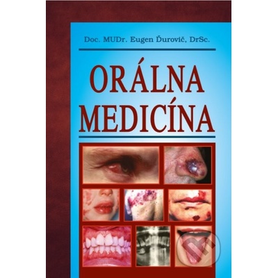 Orálna medicína - Eugen Ďurovič