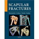Scapular fractures