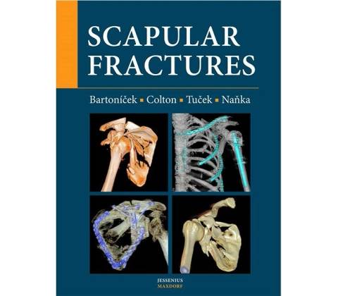 Scapular fractures