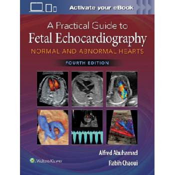 Practical Guide to Fetal Echocardiography | Alfred Z. Abuhamad, Rabih Chaoui
