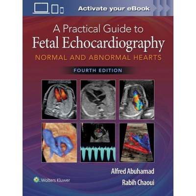 Practical Guide to Fetal Echocardiography | Alfred Z. Abuhamad, Rabih Chaoui