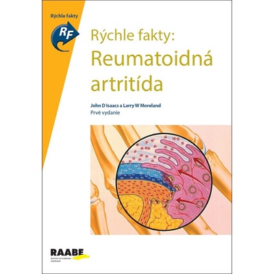 Reumatoidná artritída - John D. Isaacs, Larry W. Moreland