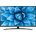LG 70UN7400