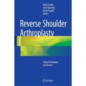 Reverse Shoulder Arthroplasty | Mark Frankle, Scott Marberry, Derek Pupello (ISBN: 9783319208398)