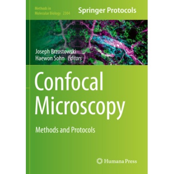 Confocal Microscopy | Joseph Brzostowski, Haewon Sohn