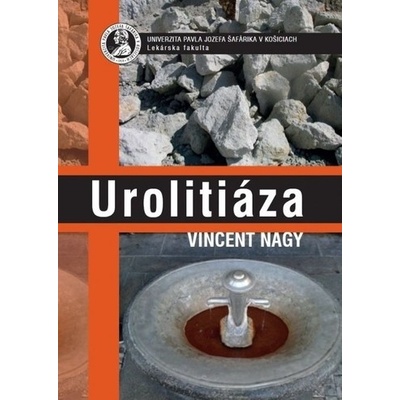 Urolitiáza - Vincent Nagy
