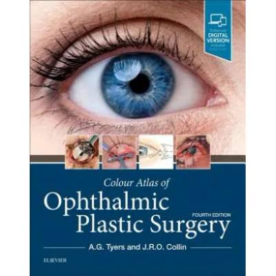 Colour Atlas of Ophthalmic Plastic Surgery | A. G. Tyers, J. R. O. Collin