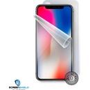 Ochranná fólia Screenshield Apple iPhone X - celé tělo