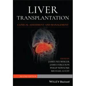 Liver Transplantation - Clinical Assessment and Management, 2nd edition | Michael R. Lucey (ISBN: 9781119633983)