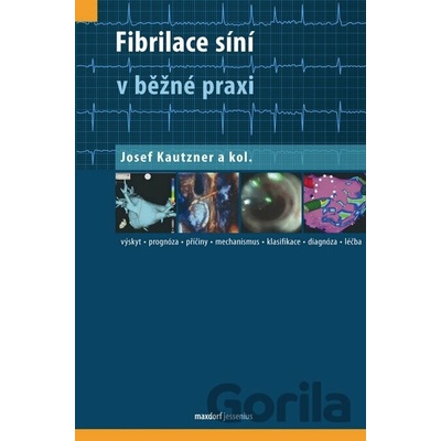 Fibrilace síní v běžné praxi - Josef Kautzner