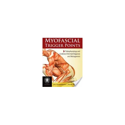 Myofascial Trigger Points: Pathophysiology And Evidence-Informed Diagnosis And Management | Jan Dommerholt, Peter Huijbregts