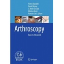 Arthroscopy