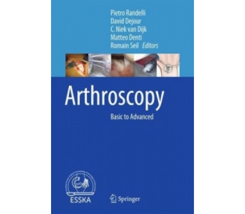 Arthroscopy