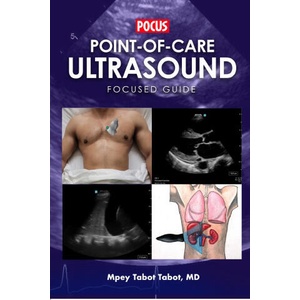 POINT-OF-CARE ULTRASOUND FOCUSED GUIDE (2022)