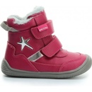 Protetika Tempra červená