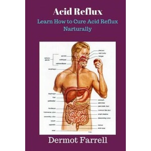 Acid Reflux: Learn How to Cure Acid Reflux Naturally | MR Dermot Farrell (ISBN: 9781546367499)