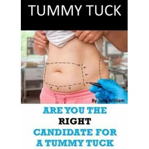 Tummy Tuck: Are You The Right Candidate For A Tummy Tuck | Tony William (ISBN: 9781974097098)