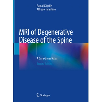 MRI of Degenerative Disease of the Spine: A Case-Based Atlas Paola D'Aprile,Alfredo Tarantino