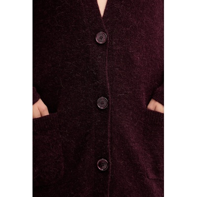 Patrizia Pepe Жилетка с вълна от алпака Patrizia Pepe (2K0323.K293)