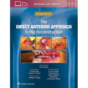 Image 1 of The Direct Anterior Approach to Hip Reconstruction | Rubin, Lee E. , Bal, B. Sonny, Moskal, Joseph T