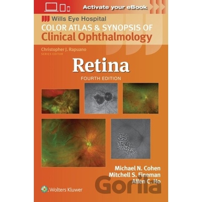 Retina - Mitchell S. Fineman