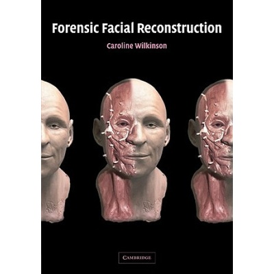 Forensic facial reconstruction - C. Wilkinson