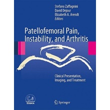 Patellofemoral Pain, Instability, and Arthritis