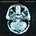 Dear Agony - Breaking Benjamin CD