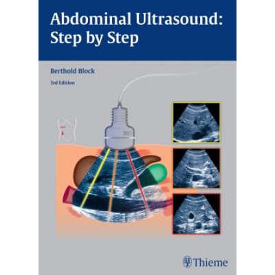 Abdominal Ultrasound: Step by Step