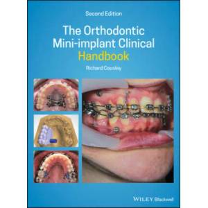 Orthodontic Mini-implant Clinical Handbook 2nd Edition | Richard Cousley (ISBN: 9781119509752)