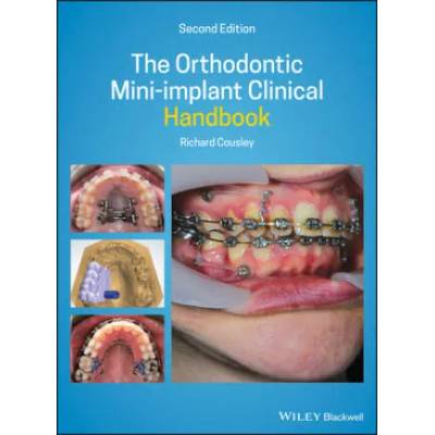 Orthodontic Mini-implant Clinical Handbook 2nd Edition | Richard Cousley