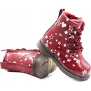 Wojtylko kotníkové boty dětské 1Z23007 dětské zimní boty červená