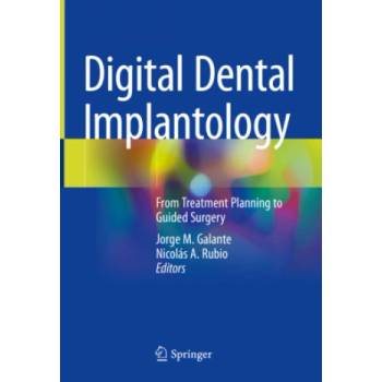 Digital Dental Implantology: From Treatment Planning to Guided Surgery
