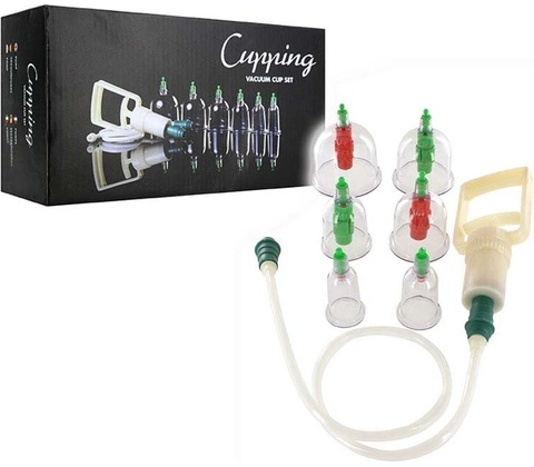 Cupping Vacuum Cup Set