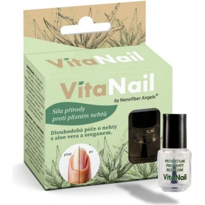 VITANAIL Lak na pevnější nehty bez plísní, 5 ml